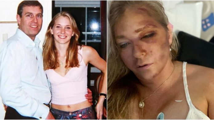 epstein-victim-virginia-roberts-claims-she-has-four-days-to-live-after-tragic-car-crash-involving-school-bus-suffers-kidney-failure-the-gateway-pundit-2025-03-31t151531-000z