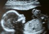 Mom Reacts to New Yorker Calling Unborn Babies ‘Errors’ to Discard