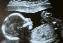 Mom Reacts to New Yorker Calling Unborn Babies ‘Errors’ to Discard