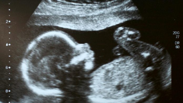 mom-reacts-to-new-yorker-calling-unborn-
